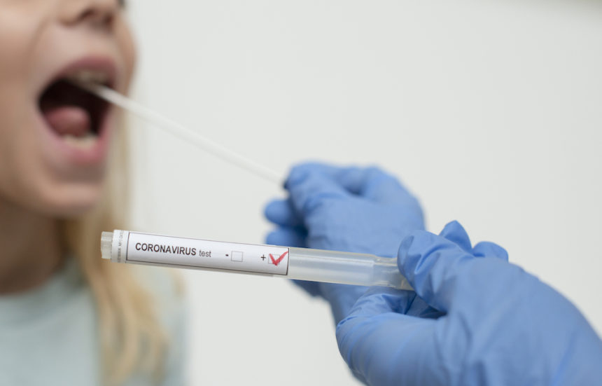 Close up of nurses hands holding buccal cotton swab and test tube ready to collect Coronarovirus test, COVID-19, 2019-nCOV analysis