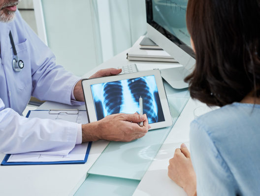 How can pharma boost lung-cancer screening rates? Awareness is just the first step
