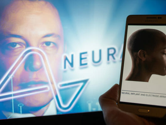 Was Elon Musk’s Neuralink conducting bad science? Bioethicists are raising questions about the brain-tech startup