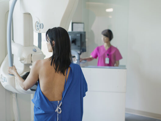 Mammograms at 40? Breast cancer screening guidelines spark fresh debate