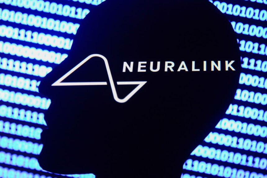 Neuralink announces it will start human trials for brain implant