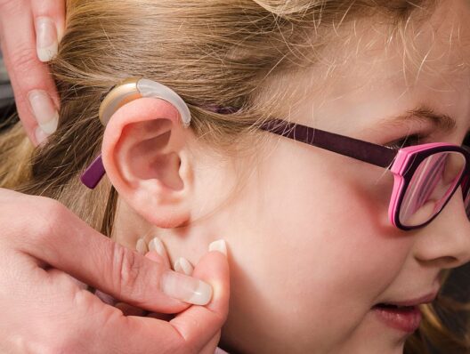 Insurance doesn’t always cover hearing aids for kids